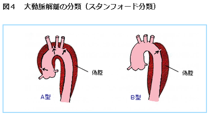 f:id:gazo-u:20190208012855p:plain
