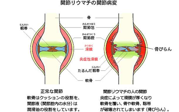 f:id:gazo-u:20191123092326p:plain