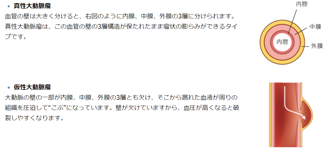 f:id:gazo-u2:20200415022711p:plain