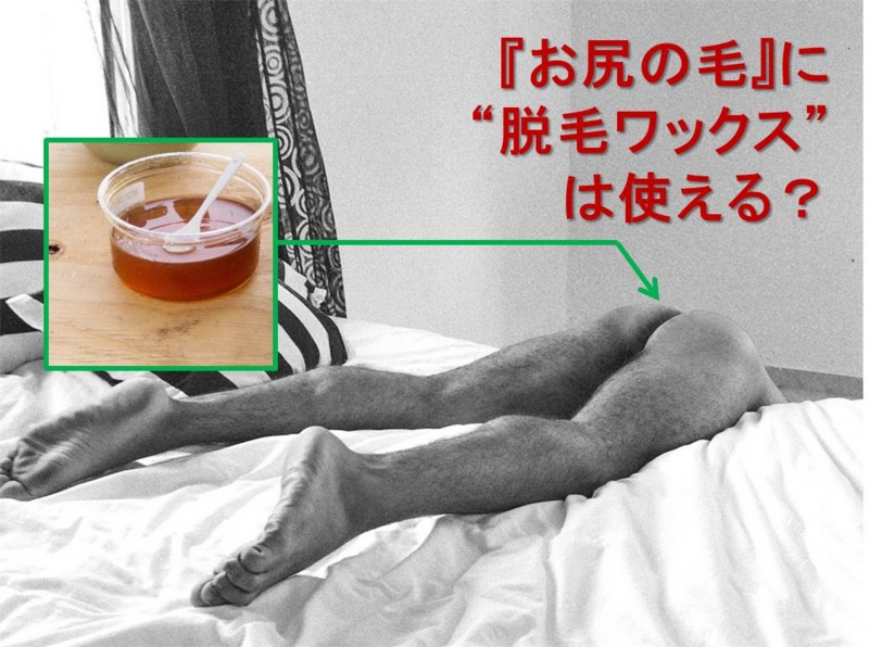 男のお尻の毛の除毛にブラジリアンワックスを使うのはあり？ 男のお尻の毛（oライン）を脱毛処理する方法！値段、期間、評判