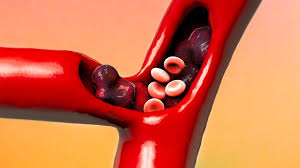 f:id:gempathy:20210322110231j:plain