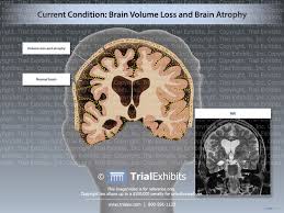 f:id:gempathy:20210413115155j:plain