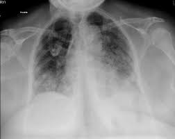 f:id:gempathy:20210524113642j:plain