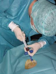 f:id:gempathy:20210526111743j:plain