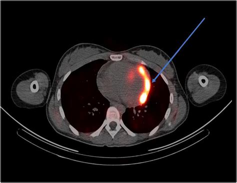 f:id:gempathy:20210916102216j:plain