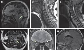 f:id:gempathy:20220121113732j:plain