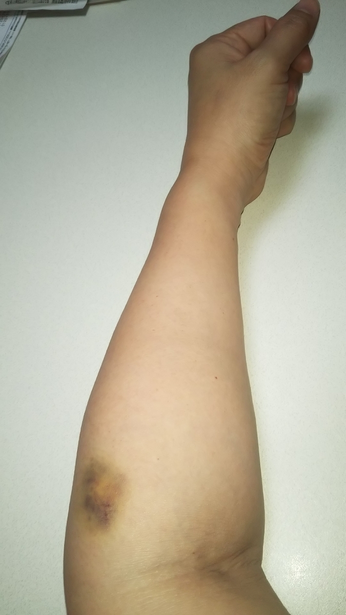 f:id:gena0116:20190901221315j:plain f:id:gena0116:20190901221315j:plain