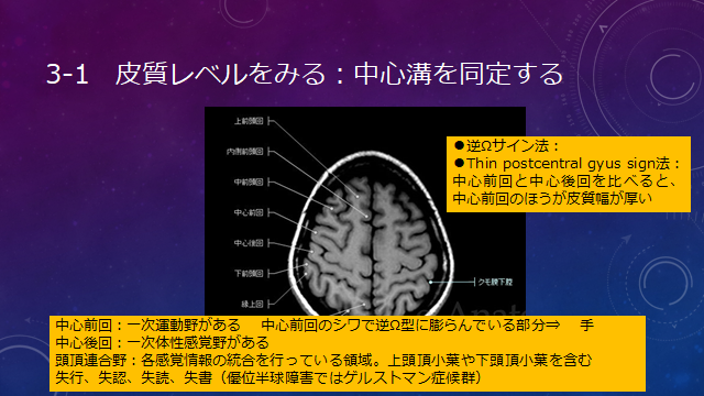 f:id:generalist_physio:20171013231409p:plain