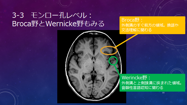 f:id:generalist_physio:20171013232020p:plain