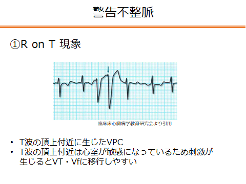 f:id:generalist_physio:20171217004136p:plain