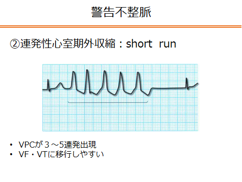 f:id:generalist_physio:20171217004146p:plain