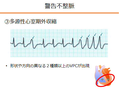 f:id:generalist_physio:20171217004155p:plain