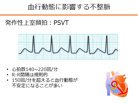 f:id:generalist_physio:20171217004518p:plain