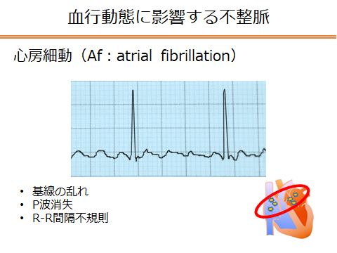 f:id:generalist_physio:20171217004530p:plain