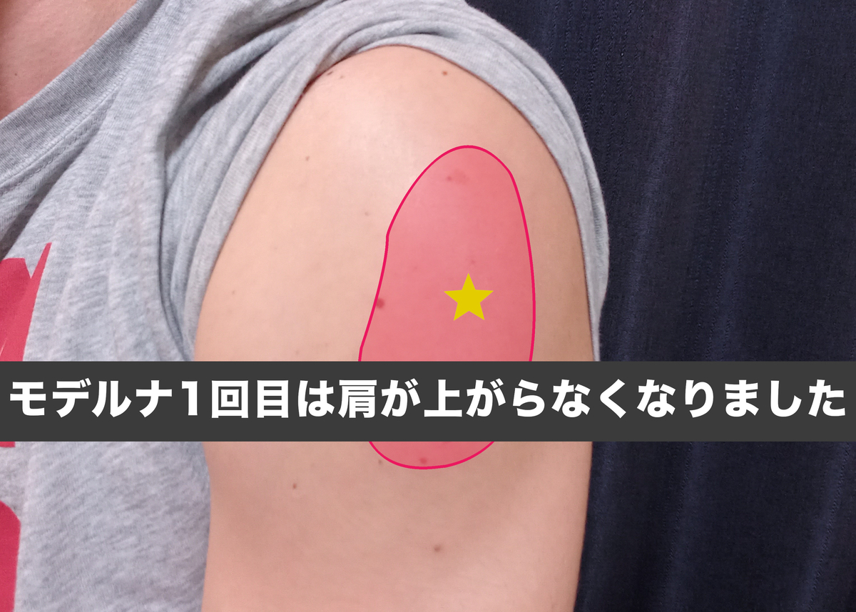 武田／モデルナ社の新型コロナワクチン
