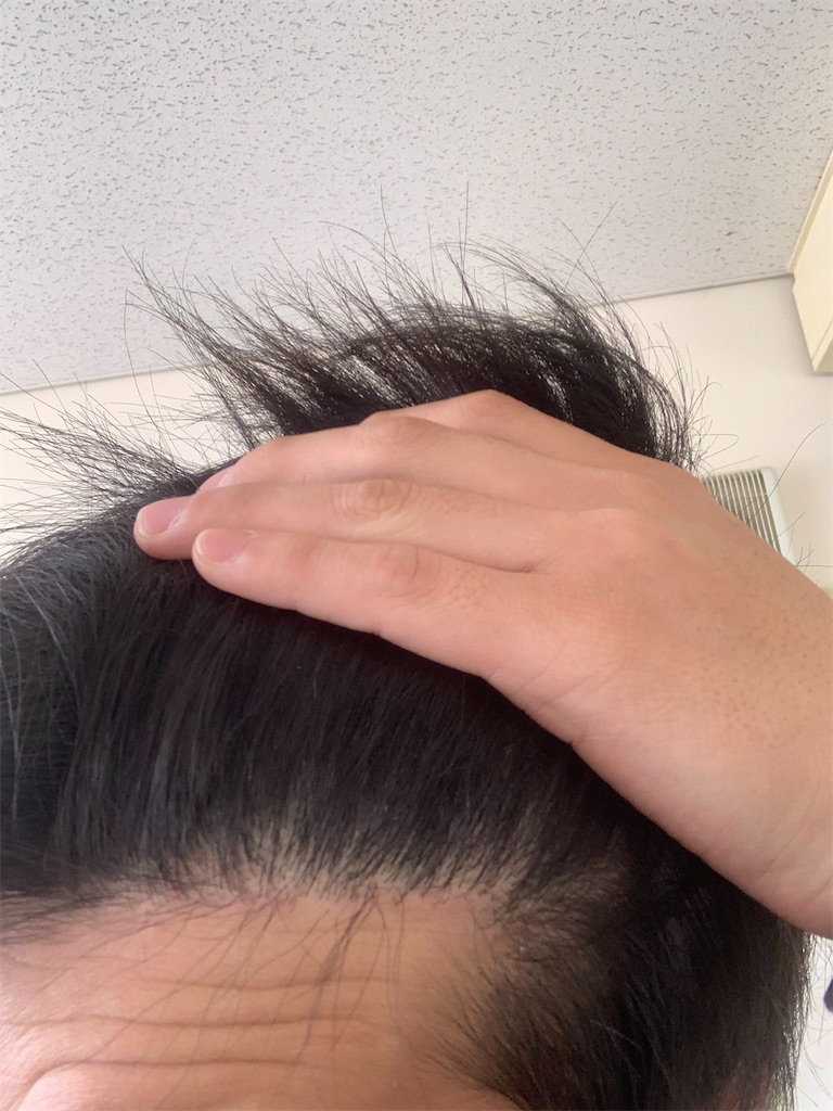 f:id:genzaburou13:20200413103411j:image f:id:genzaburou13:20200413103411j:image