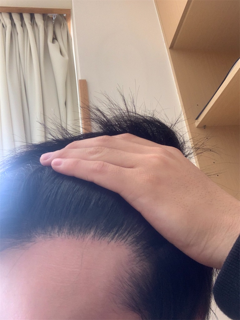 f:id:genzaburou13:20200515104251j:image f:id:genzaburou13:20200515104251j:image