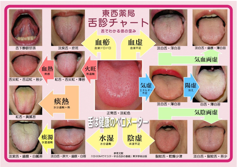 f:id:gimresi:20200208135220p:plain f:id:gimresi:20200208135220p:plain