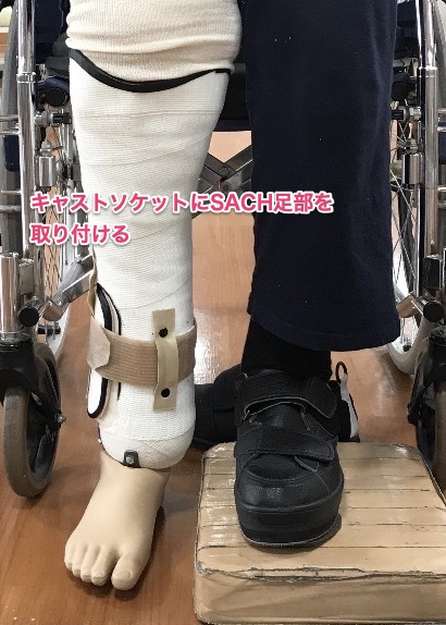 右膝下義足 下腿義足(骨格) | 札幌市や帯広市で義肢・装具の製作は創業明治36年の