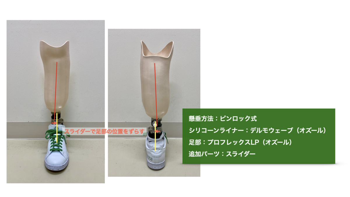 【教材にどうぞ】　右膝下義足 教材にどうぞ】右膝下義足