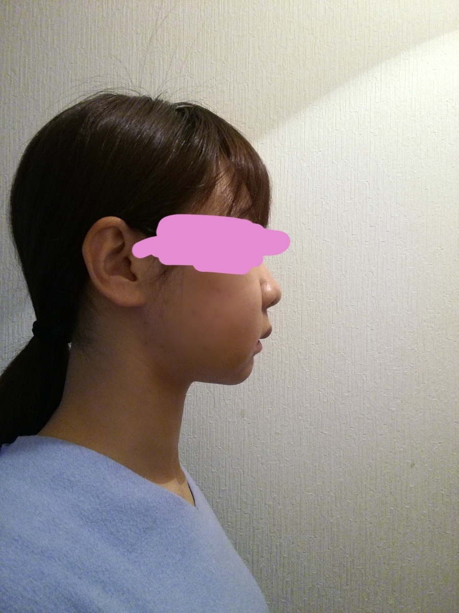 f:id:gkhki:20190407224814j:plain f:id:gkhki:20190407224814j:plain