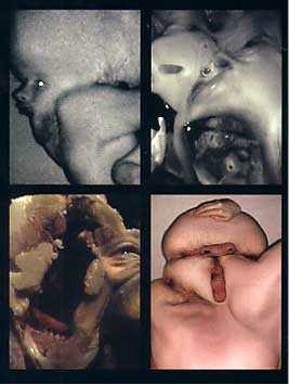 f:id:globalhead:20050729021921j:image f:id:globalhead:20050729021921j:image