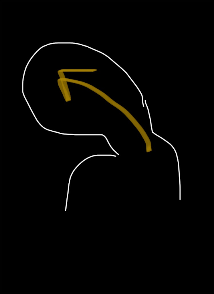 f:id:goblin-red:20251204144902j:image