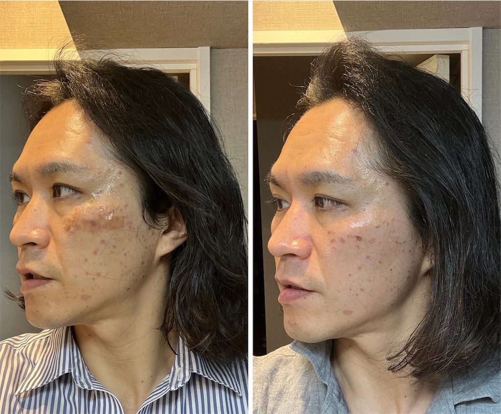 f:id:gohatori:20230314223205j:image f:id:gohatori:20230314223205j:image