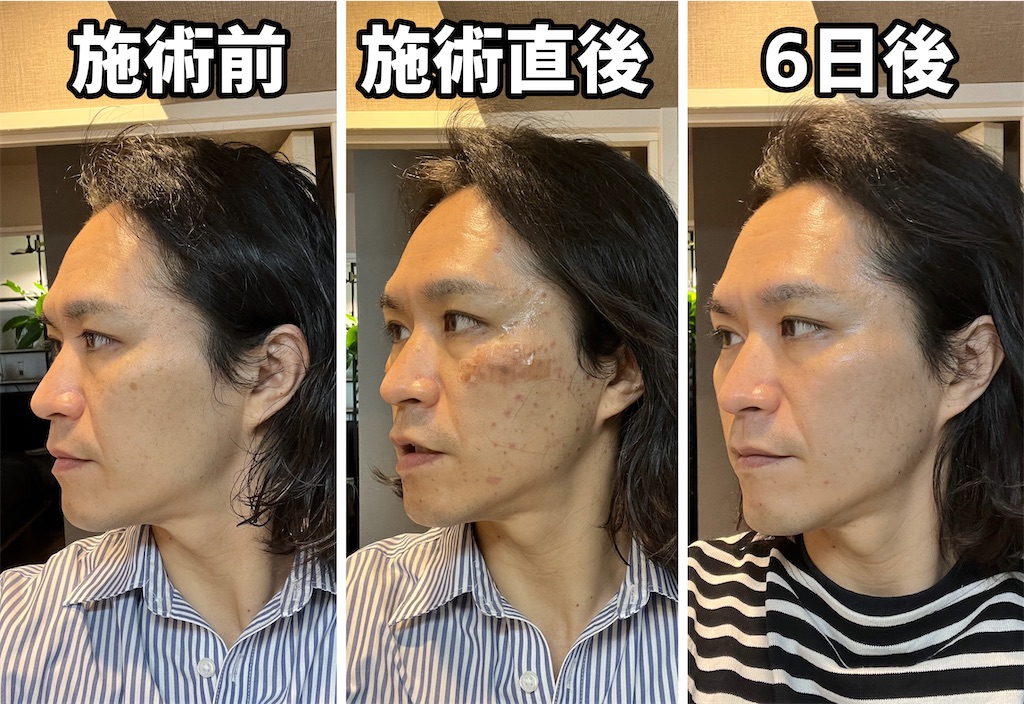 f:id:gohatori:20230317074842j:image f:id:gohatori:20230317074842j:image