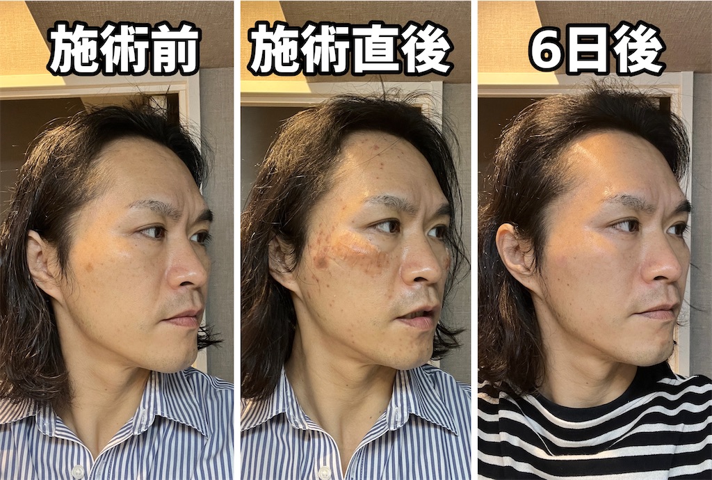 f:id:gohatori:20230317074845j:image f:id:gohatori:20230317074845j:image