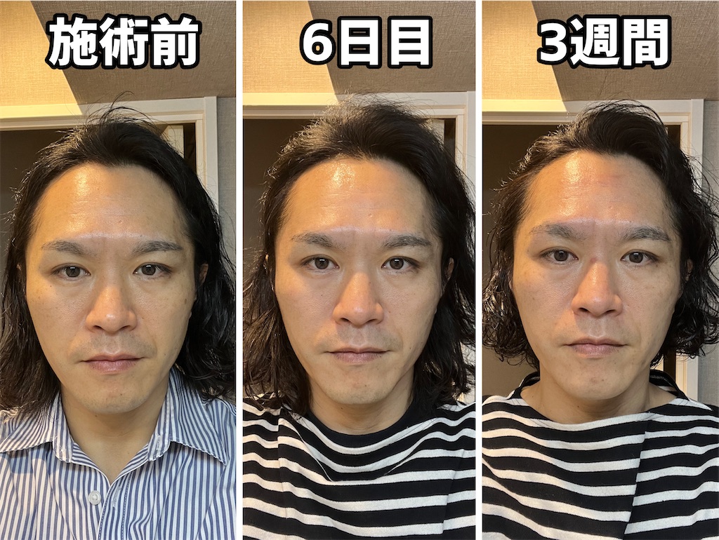 f:id:gohatori:20230402194403j:image