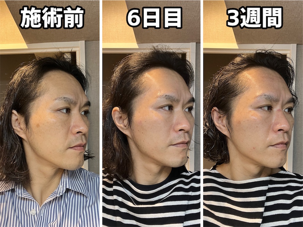 f:id:gohatori:20230402194407j:image