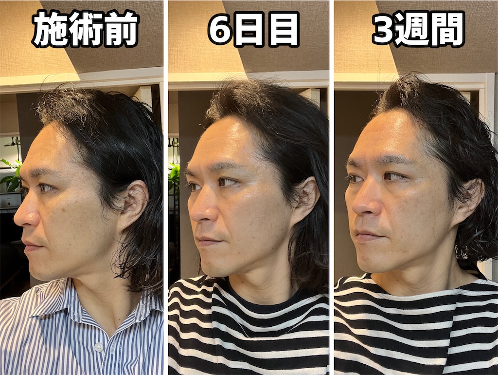 f:id:gohatori:20230402194410j:image