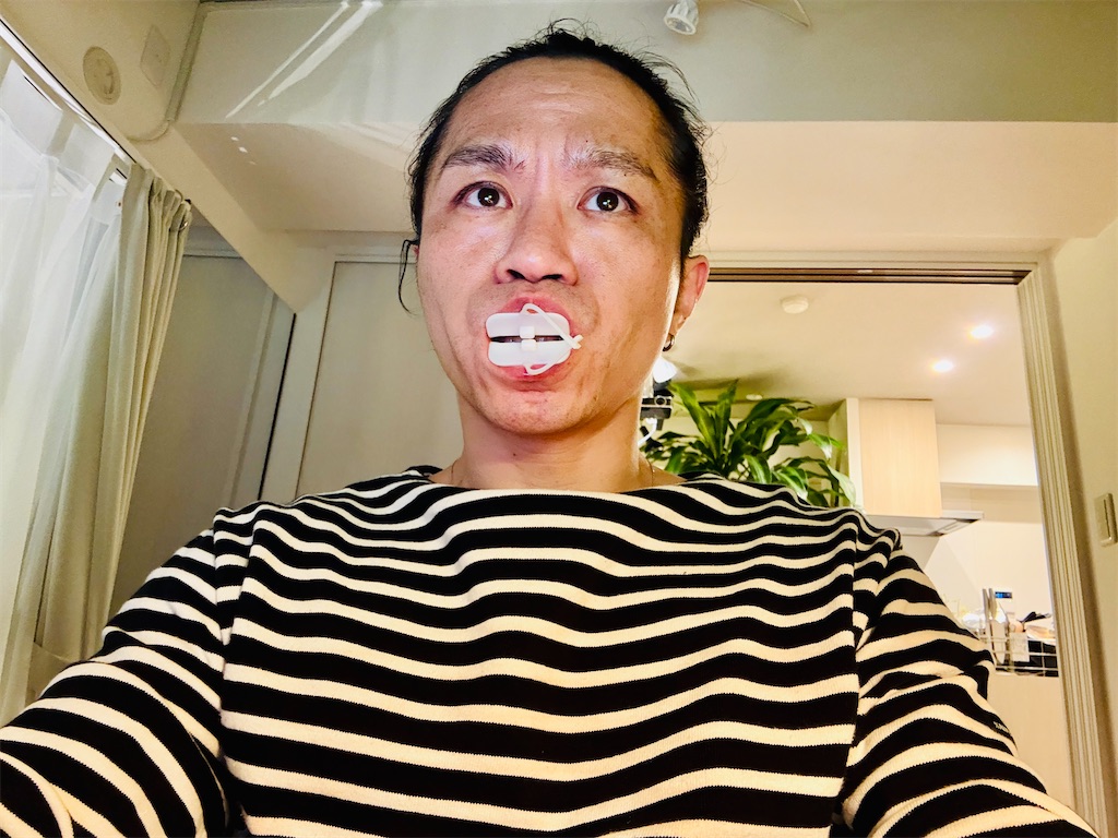 f:id:gohatori:20260222194424j:image