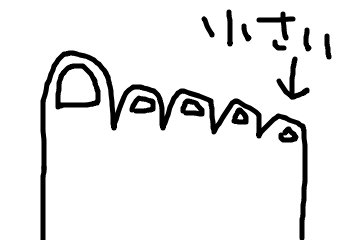 足の小指の爪が割れて痛い セシボンのいつかはラジオdjに