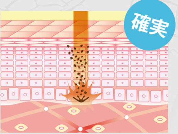 f:id:goldbird777:20191107164608j:plain f:id:goldbird777:20191107164608j:plain