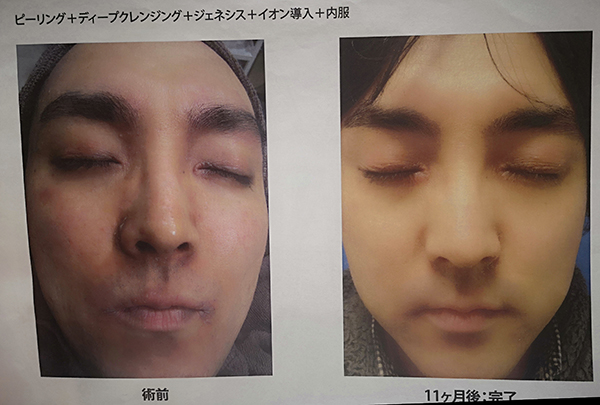 f:id:goldbird777:20191110005645j:plain f:id:goldbird777:20191110005645j:plain