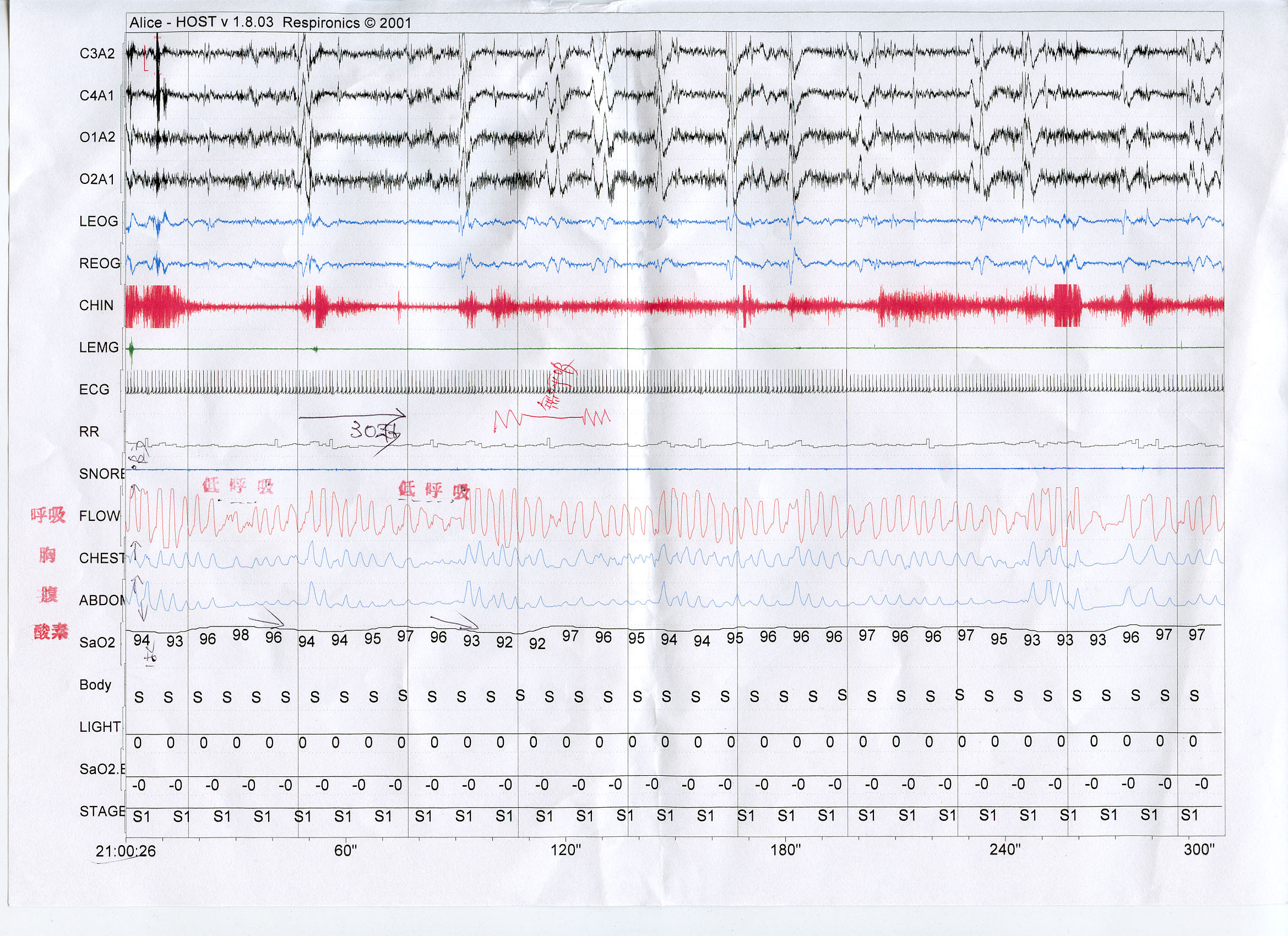 f:id:goldhead:20100531124651j:image:w500 f:id:goldhead:20100531124651j:image:w500