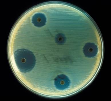 f:id:gomasan8:20211121085021p:plain