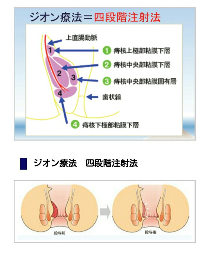 f:id:gonengomogenki:20191031090105j:image