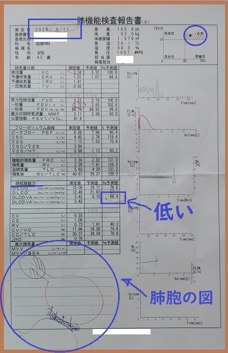 f:id:gonengomogenki:20200615180825j:plain