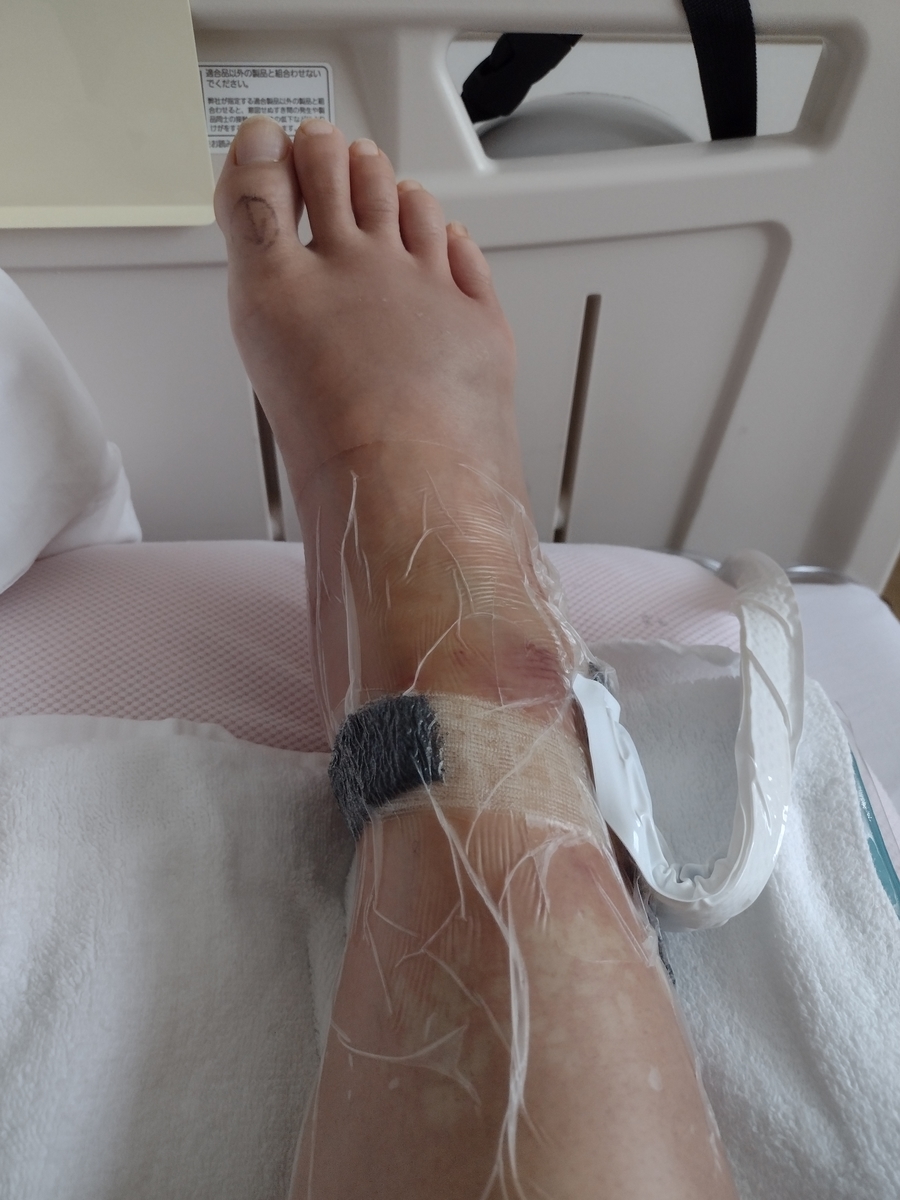 f:id:goodmotion55:20211016204854j:plain