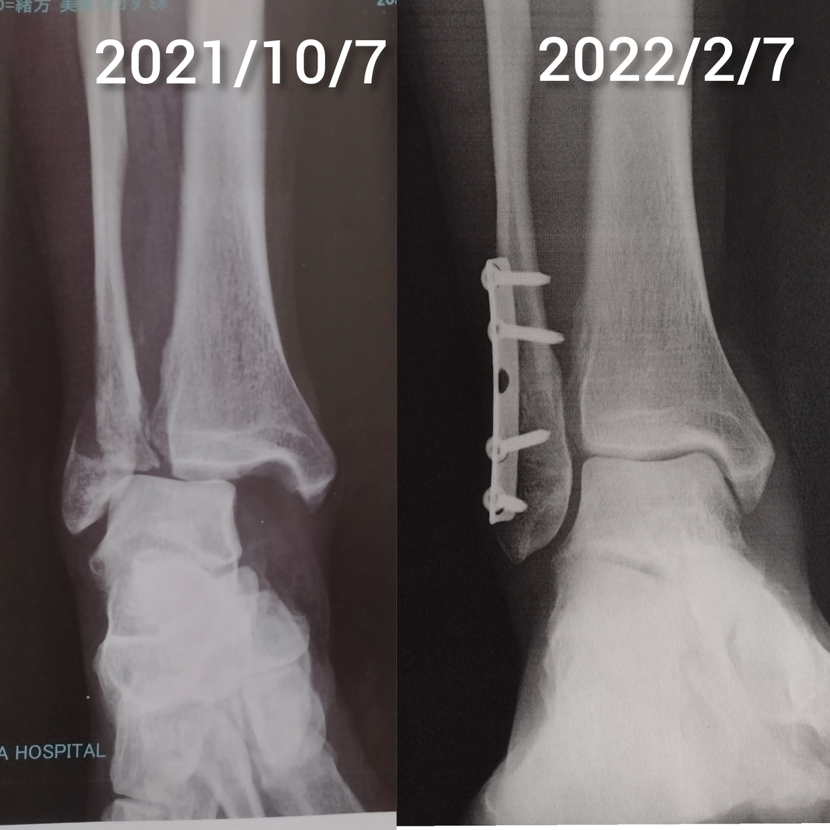 f:id:goodmotion55:20220208072331j:plain