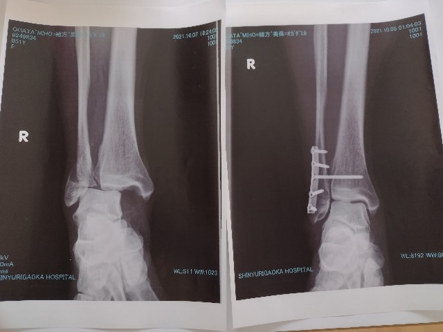 f:id:goodmotion55:20221031121939j:image