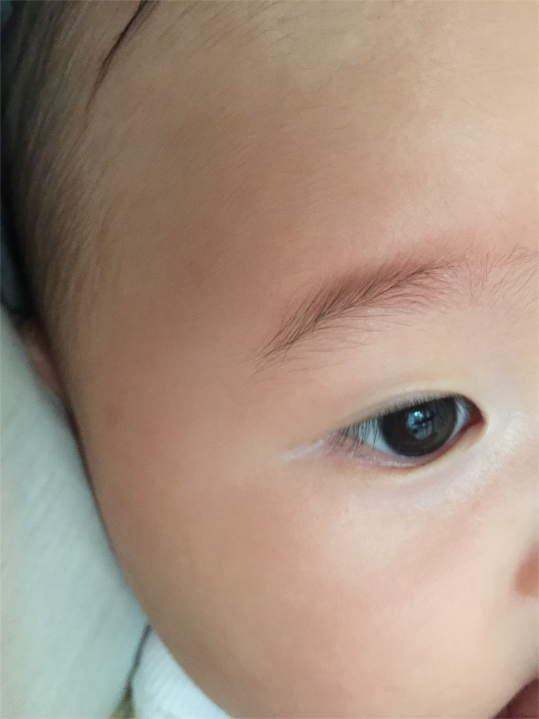 二重になった 4ヶ月である日突然片目だけ ポテ子の妊娠 出産 育児日記