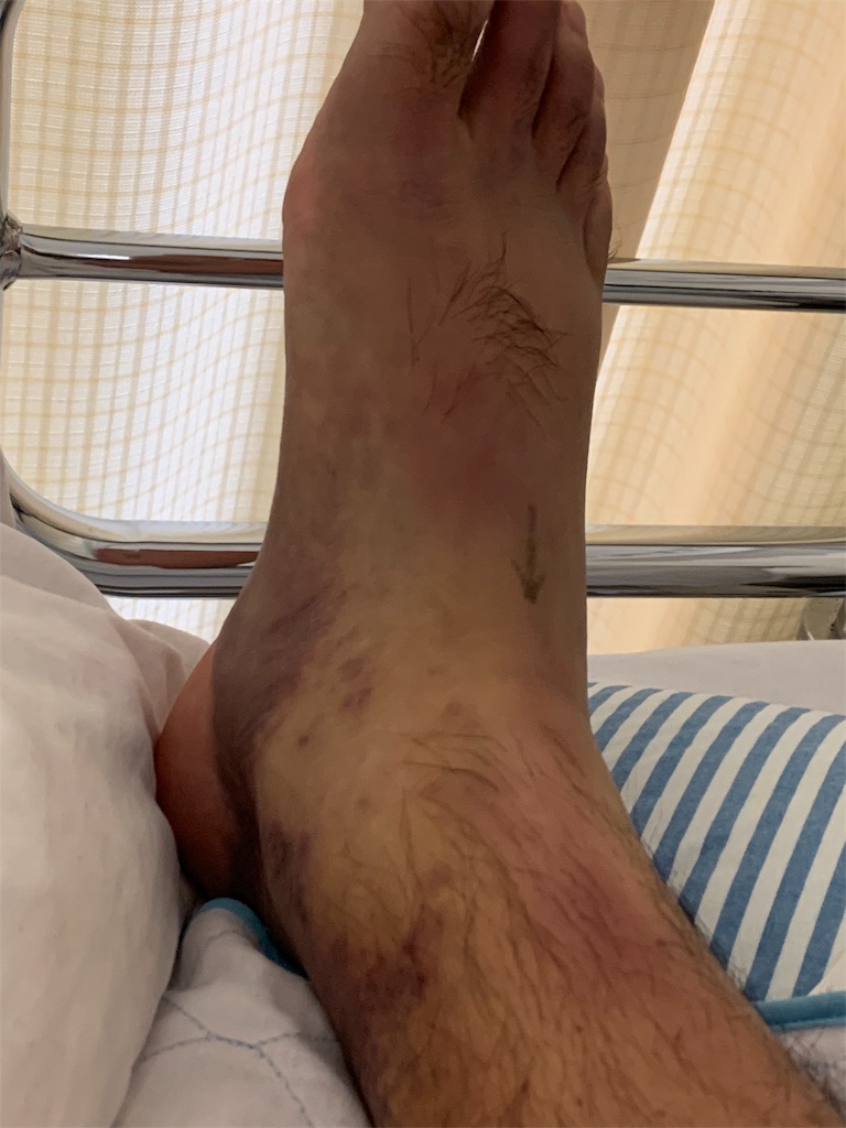 f:id:gossyan510:20190724152350j:image