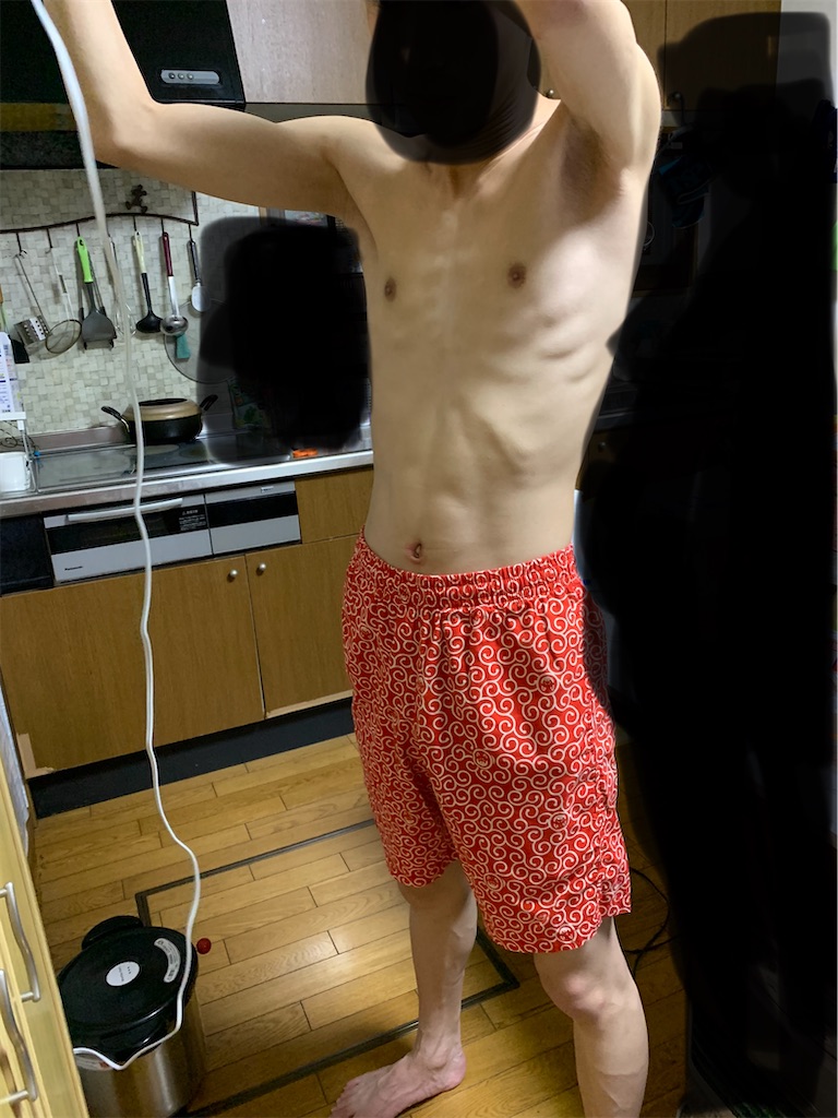 f:id:goukakuigakubu:20220817101618j:image f:id:goukakuigakubu:20220817101618j:image