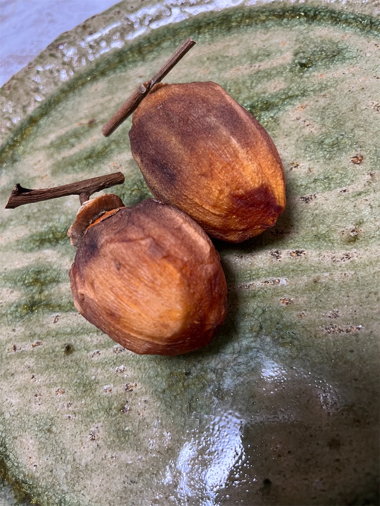 f:id:goukakuigakubu:20231110093705j:image f:id:goukakuigakubu:20231110093705j:image