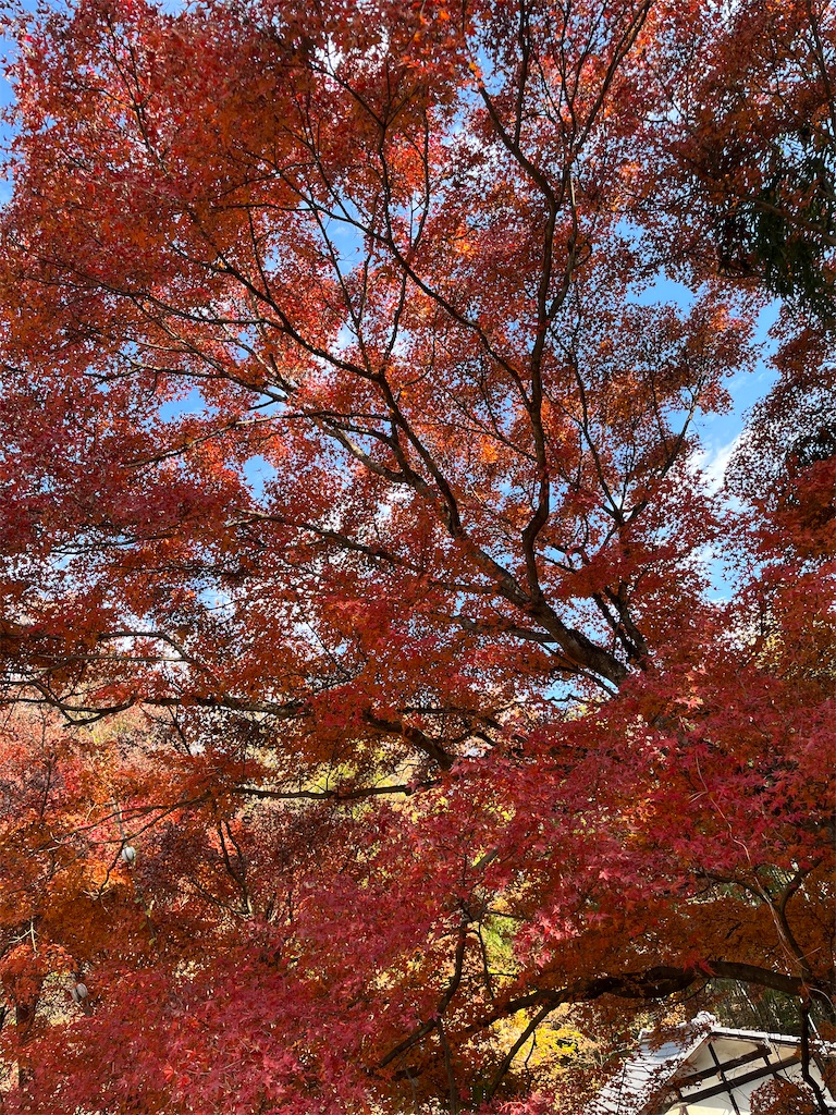 f:id:goukakuigakubu:20231127110003j:image f:id:goukakuigakubu:20231127110003j:image