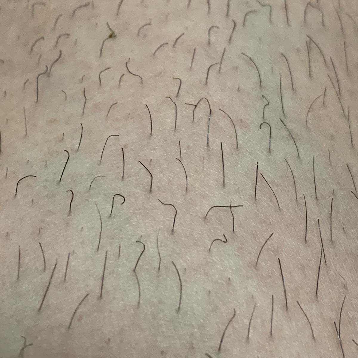 足の毛の様子